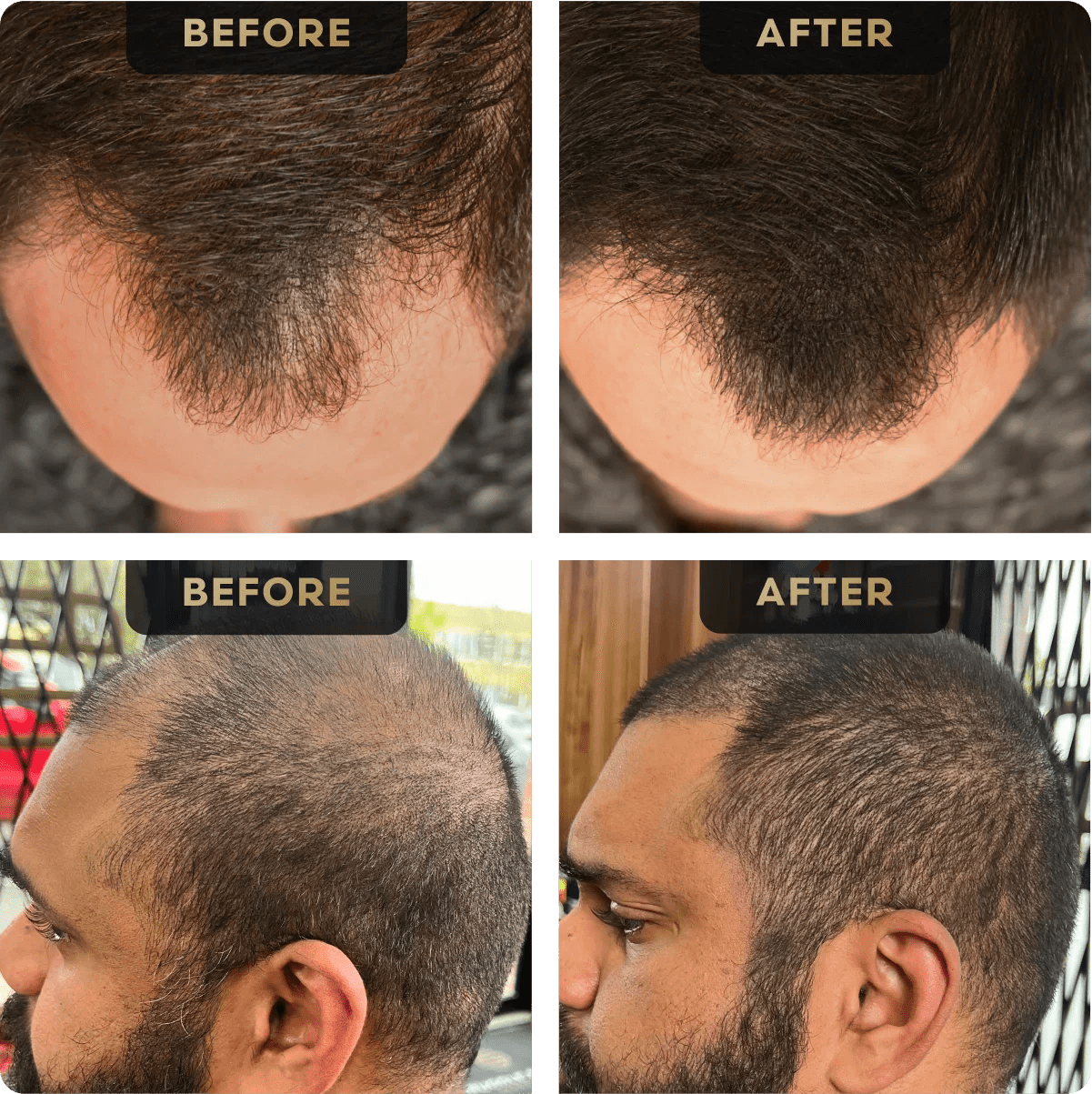 Hair Concealer - Faithful Nutrition