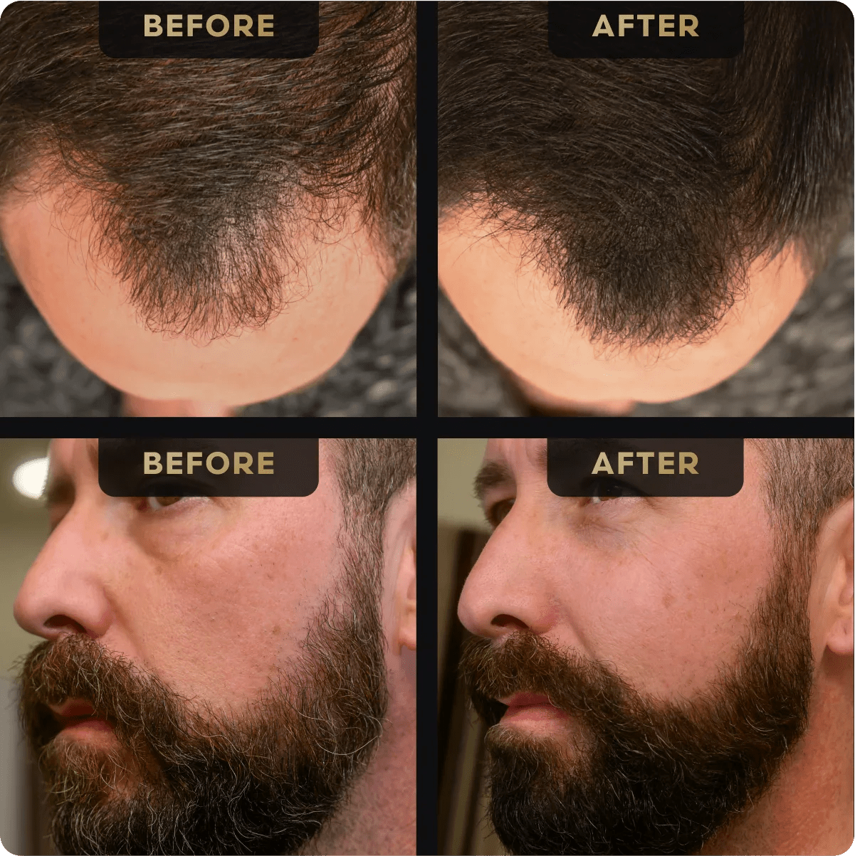 Beard Pen and Hair Concealer Bundle - Hair Concealer - Faithful Nutrition