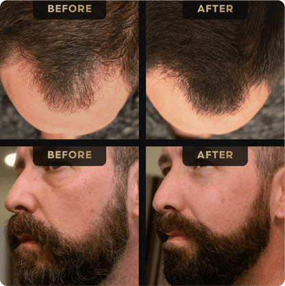 Beard Pen and Hair Concealer Bundle - Hair Concealer - Faithful Nutrition