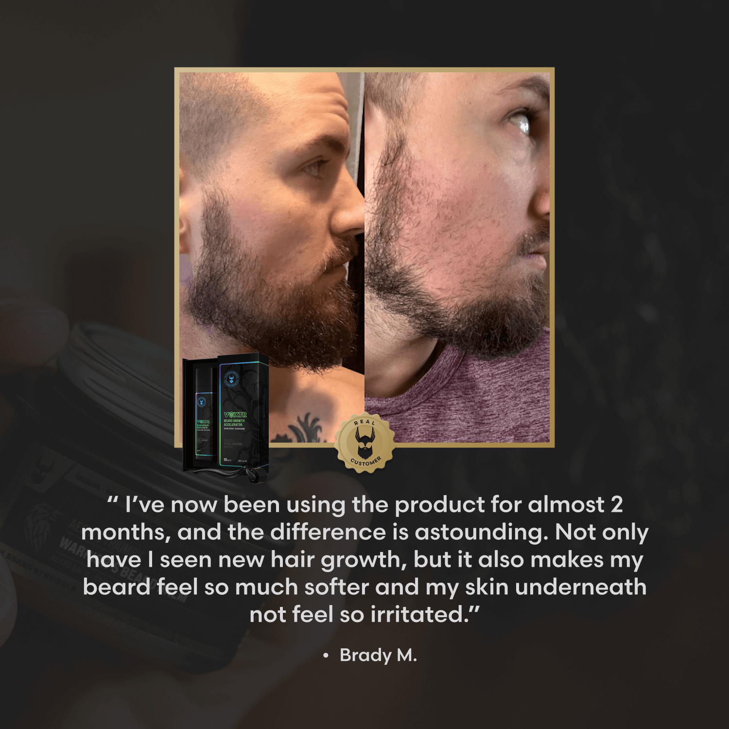 Voxtr Beard Growth Kit - Kit - Faithful Nutrition